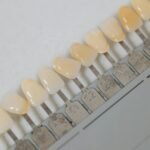 Here’s How You Can Save Money On Dental Implants