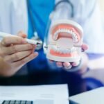 The Benefits of Dental Implants: A Permanent Solution for Your Smile