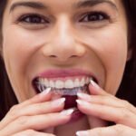 Discover the Benefits of Invisalign Solutions for a Confident Smile in New Zealand